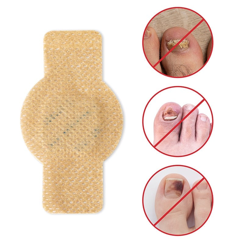FungalPatch™ | Gepflegte Nägel ohne Aufwand | 2+1 GRATIS