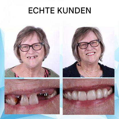 50% Rabatt | DentaFlex™ - Unterstützt das natürliche Aussehen & Gefühl Ihres Lächelns