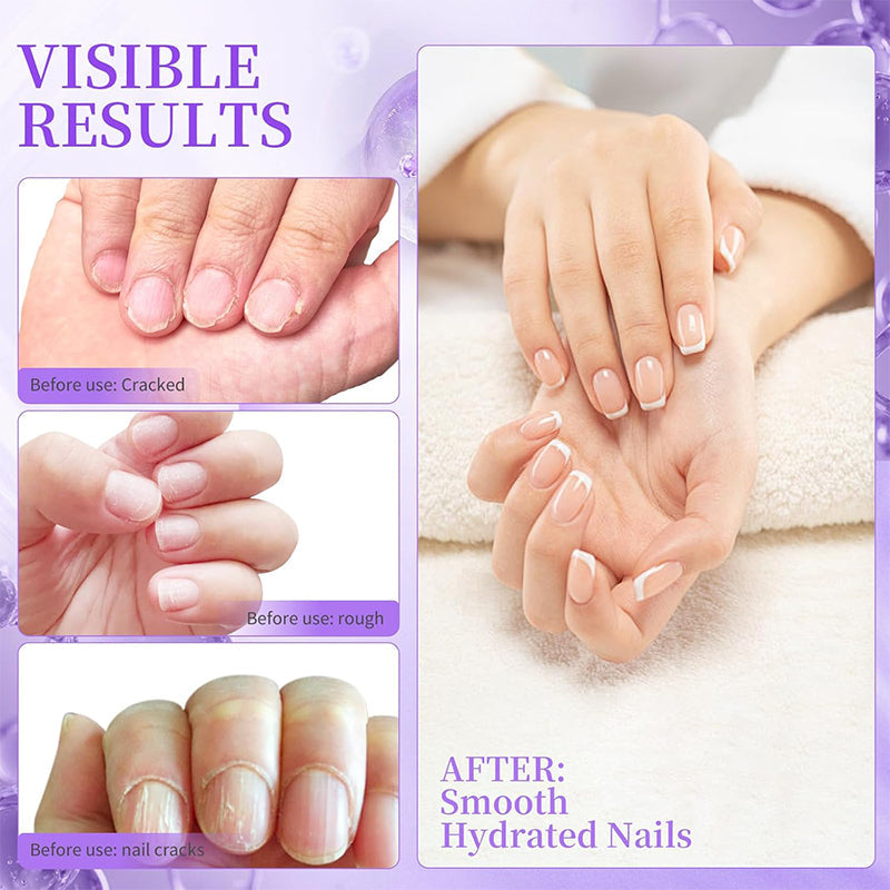 1+1 GRATIS | NailCare™ | Pflegestift für trockene Nagelhaut – Gepflegte Nägel in Sekunden, überall