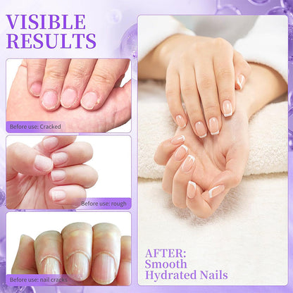 1+1 GRATIS | NailCare™ | Pflegestift für trockene Nagelhaut – Gepflegte Nägel in Sekunden, überall