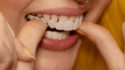 LumaGrin™ Snap-On Cosmetic Veneers – Temporäres Lächeln für Fotos & Events