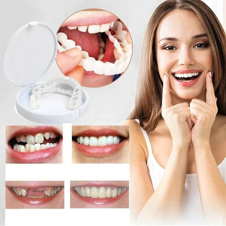 LumaGrin™ Snap-On Cosmetic Veneers – Temporäres Lächeln für Fotos & Events