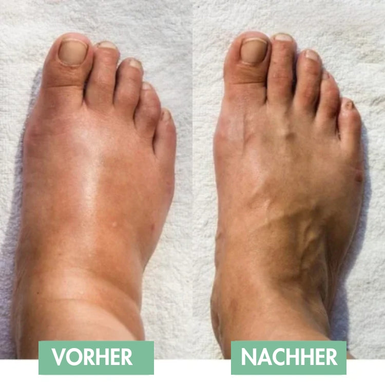 Revivax™ | Innovative EMS-Fußmassage für sofortige Erleichterung & tiefe Entspannung