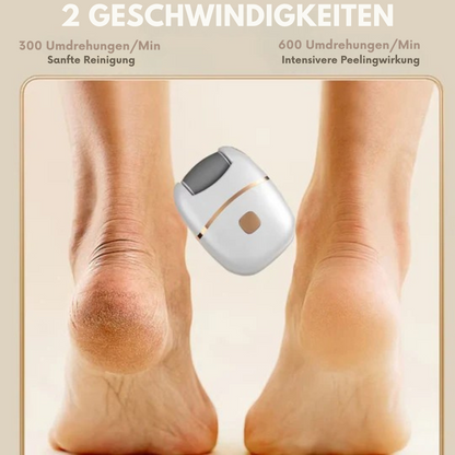 Seidenglatte Füße in Minuten | SmoothSpin™ Hornhautentferner - 50 % RABATT