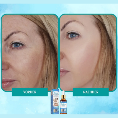 YouthGlow™ – Botox-freies Anti-Aging-Serum für strahlende, jugendliche Haut | 1 + 1 Gratis