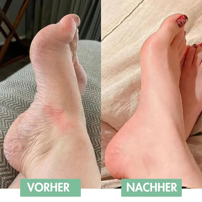Revivax™ | Innovative EMS-Fußmassage für sofortige Erleichterung & tiefe Entspannung