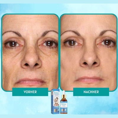YouthGlow™ – Botox-freies Anti-Aging-Serum für strahlende, jugendliche Haut | 1 + 1 Gratis