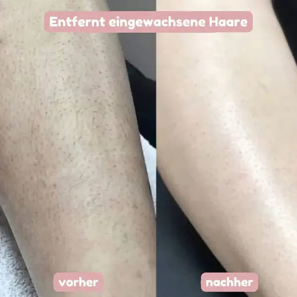 SeidenGlanz™ | 2 in 1 Damenrasierer für glatte und gepflegte Haut