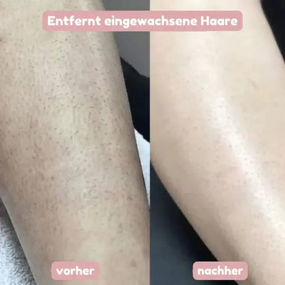 SeidenGlanz™ | 2 in 1 Damenrasierer für glatte und gepflegte Haut