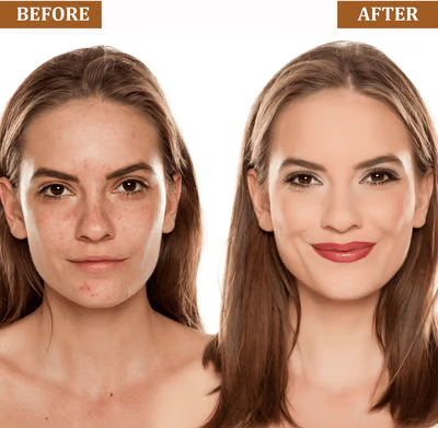 1+1 GRATIS | ElaraGlow™ – Perfekte Haut, die sich den ganzen Tag wie Magie anfühlt