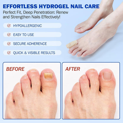 PureNail™ - Optimale Wiederherstellung Ihrer Nägel | 50% RABATT