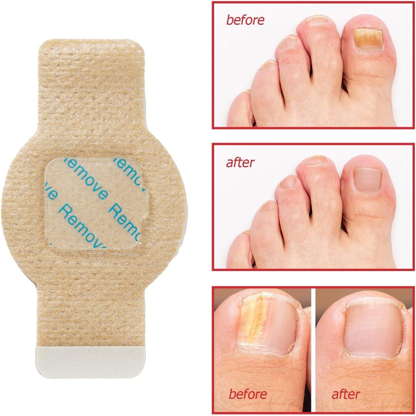 PureNail™ - Optimale Wiederherstellung Ihrer Nägel | 50% RABATT