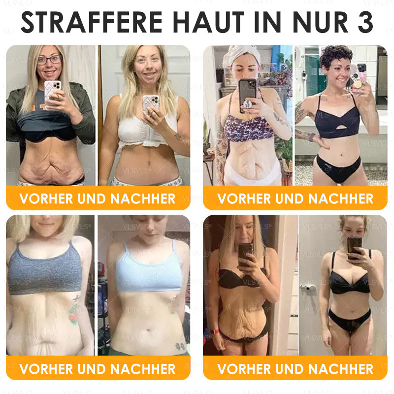 HealSkin™ – Straffende Anti-Aging-Creme mit Bienengift-Peptiden | Nur heute 50% RABATT