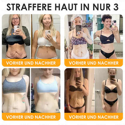 HealSkin™ – Straffende Anti-Aging-Creme mit Bienengift-Peptiden | Nur heute 50% RABATT
