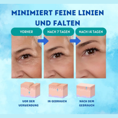 YouthGlow™ – Botox-freies Anti-Aging-Serum für strahlende, jugendliche Haut | 1 + 1 Gratis