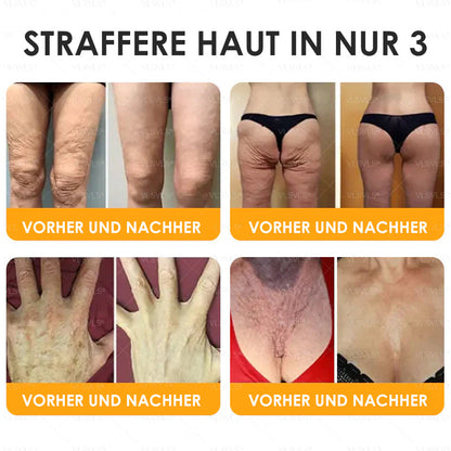 HealSkin™ – Straffende Anti-Aging-Creme mit Bienengift-Peptiden | Nur heute 50% RABATT