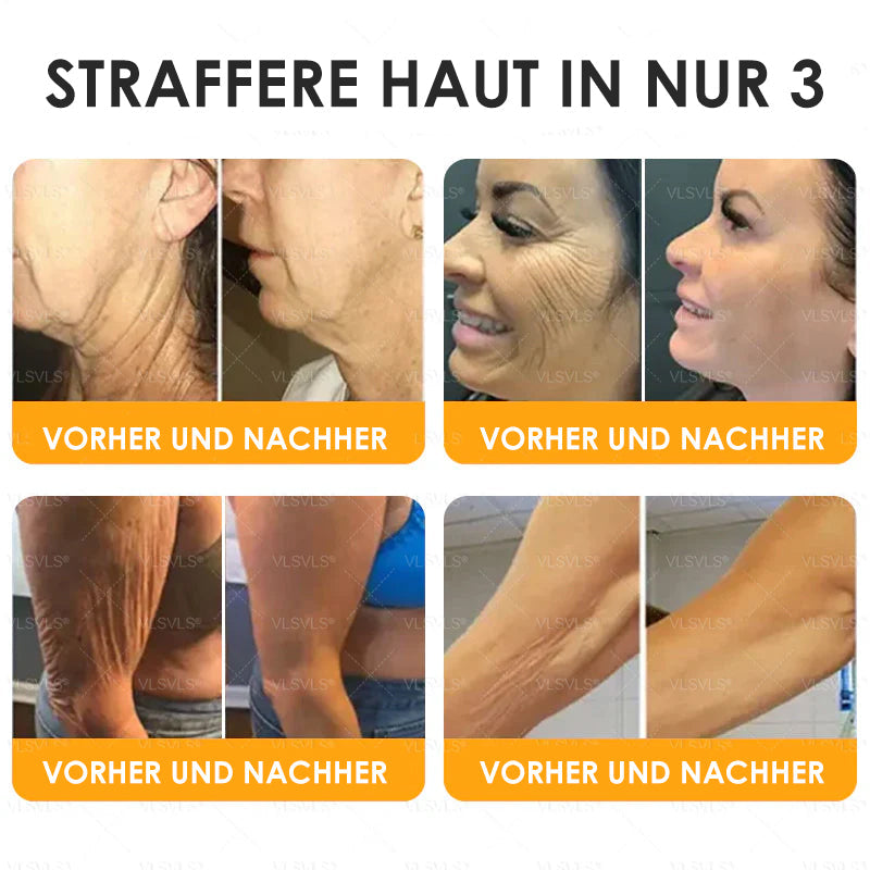 HealSkin™ – Straffende Anti-Aging-Creme mit Bienengift-Peptiden | Nur heute 50% RABATT