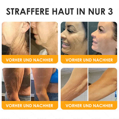 HealSkin™ – Straffende Anti-Aging-Creme mit Bienengift-Peptiden | Nur heute 50% RABATT