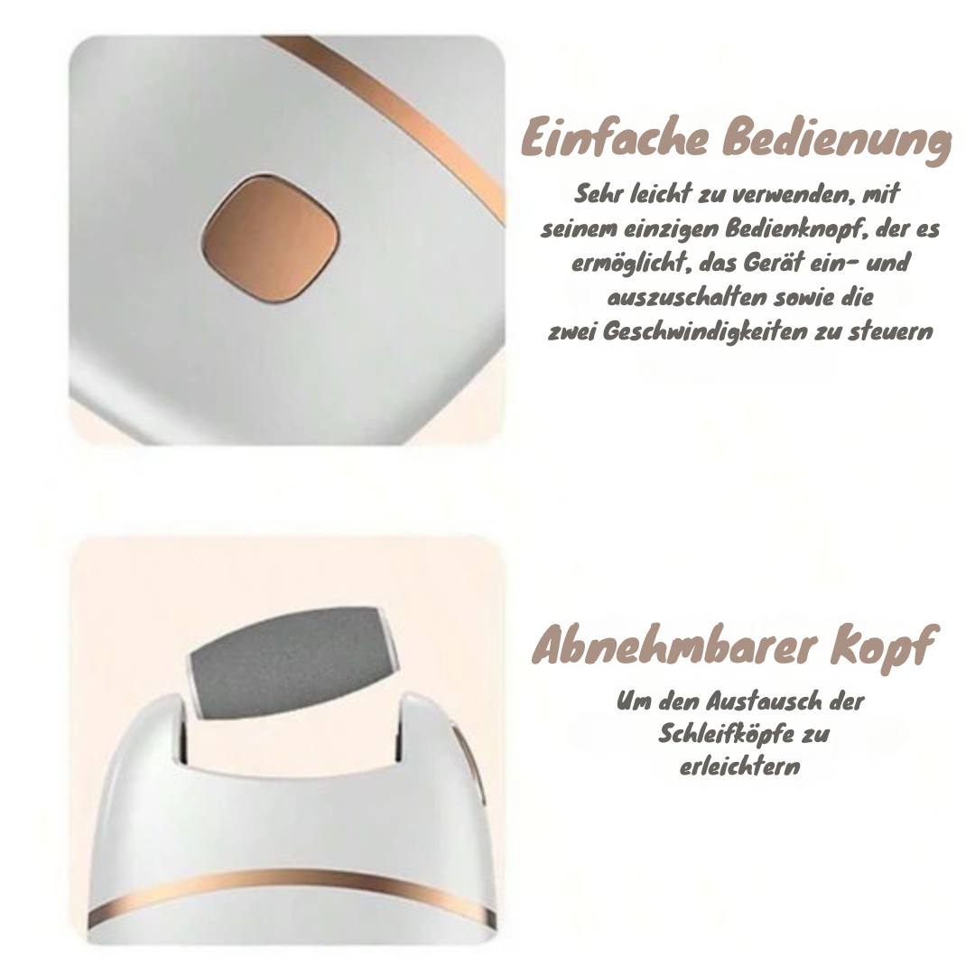 Seidenglatte Füße in Minuten | SmoothSpin™ Hornhautentferner - 50 % RABATT
