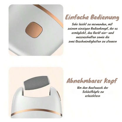 Seidenglatte Füße in Minuten | SmoothSpin™ Hornhautentferner - 50 % RABATT