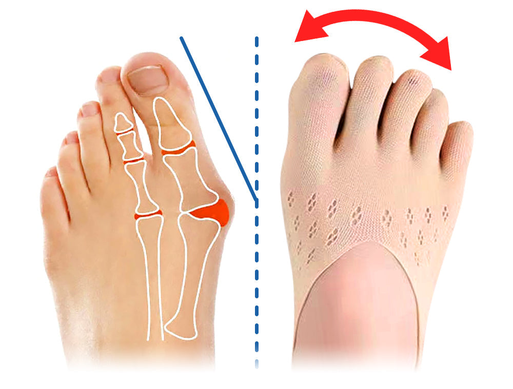 StrideEase™ | Orthopädische Einlegesohlen