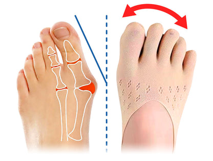 StrideEase™ | Orthopädische Einlegesohlen