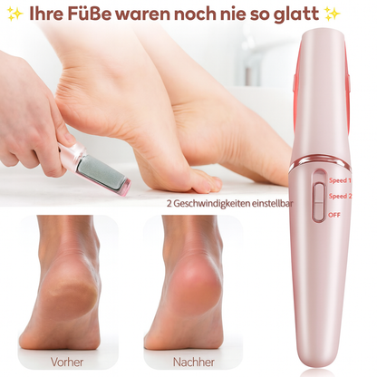 Jetzt sichern: SilkHeel™ – Professionelle Hornhautentfernung für babyweiche Füße | 50 % RABATT