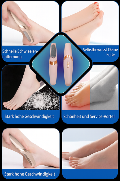 Jetzt sichern: SilkHeel™ – Professionelle Hornhautentfernung für babyweiche Füße | 50 % RABATT