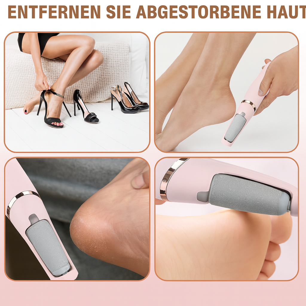 Jetzt sichern: SilkHeel™ – Professionelle Hornhautentfernung für babyweiche Füße | 50 % RABATT