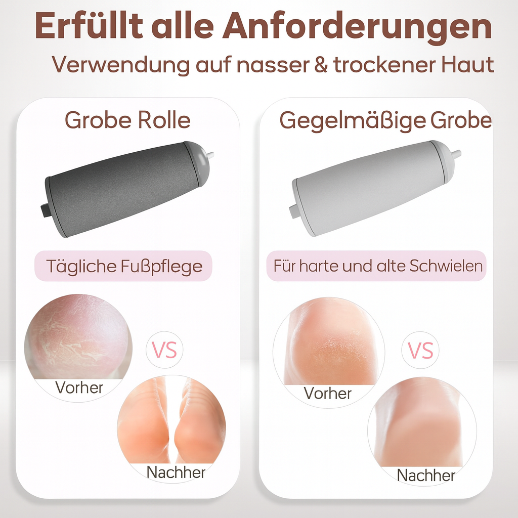 Jetzt sichern: SilkHeel™ – Professionelle Hornhautentfernung für babyweiche Füße | 50 % RABATT