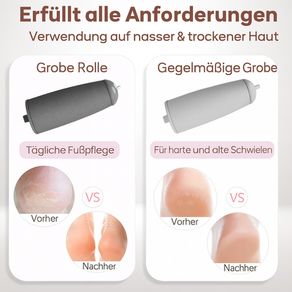Jetzt sichern: SilkHeel™ – Professionelle Hornhautentfernung für babyweiche Füße | 50 % RABATT