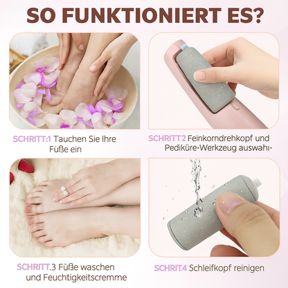 Jetzt sichern: SilkHeel™ – Professionelle Hornhautentfernung für babyweiche Füße | 50 % RABATT