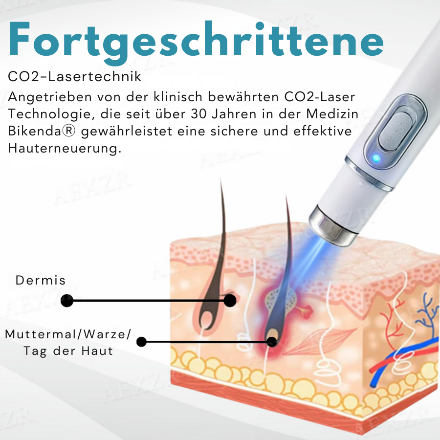 Jetzt 1+1 GRATIS sichern | Bikenda™ CO₂-Laser für schnelle Hautverjüngung