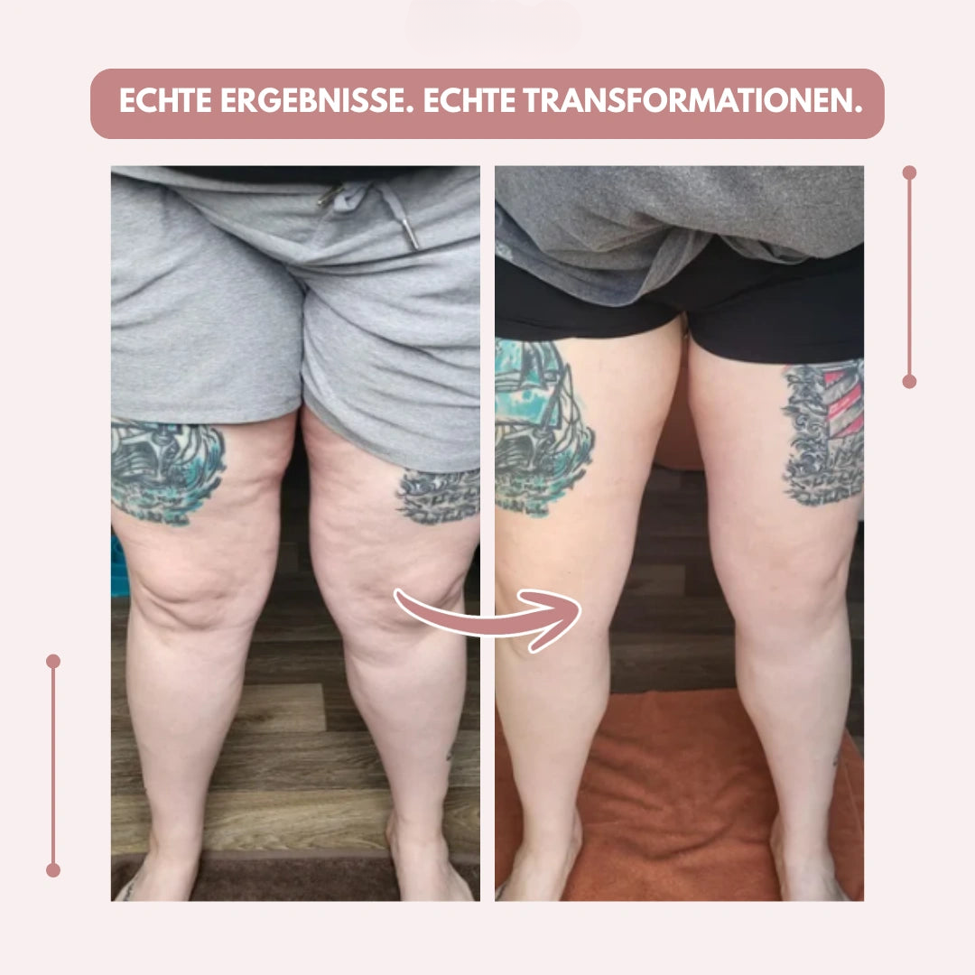 Kompressionsleggings Damen hohe Taille formend