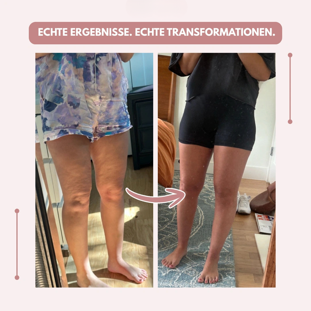 Kompressionsleggings Damen hohe Taille formend