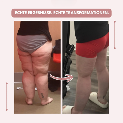 Kompressionsleggings Damen hohe Taille formend