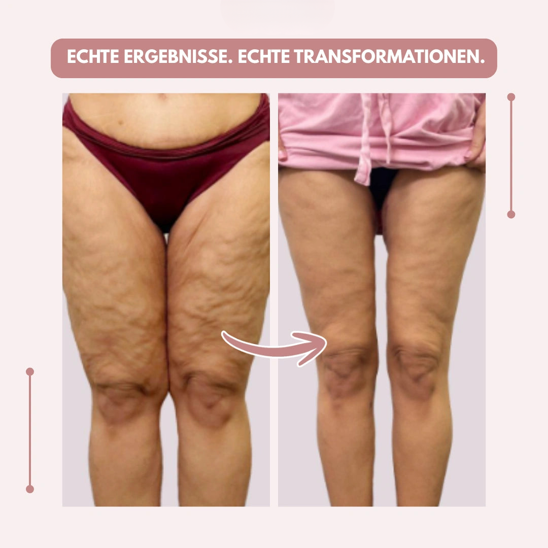 Kompressionsleggings Damen hohe Taille formend