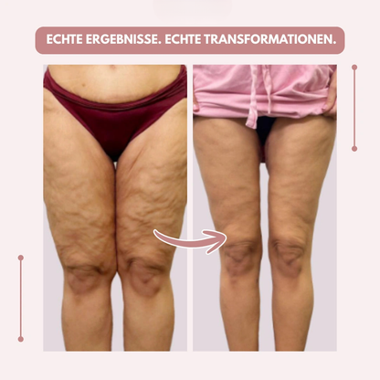 Kompressionsleggings Damen hohe Taille formend