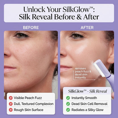 SilkGlow™ Dermaplaning-Gerät – Glatte Haut wie aus dem Salon