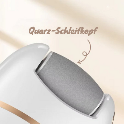 Seidenglatte Füße in Minuten | SmoothSpin™ Hornhautentferner - 50 % RABATT