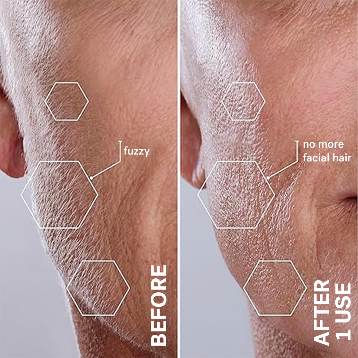 SilkGlow™ Dermaplaning-Gerät – Glatte Haut wie aus dem Salon