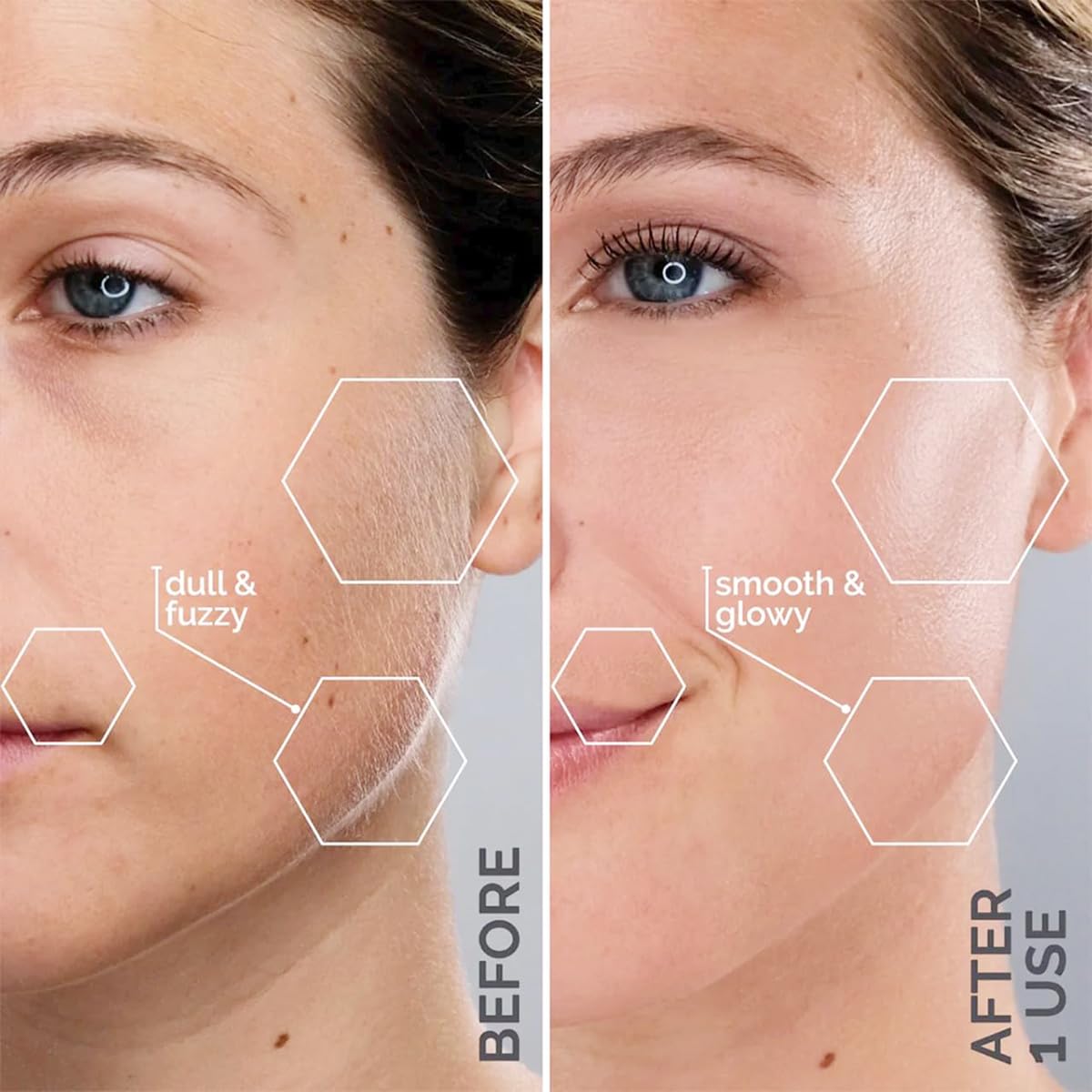 SilkGlow™ Dermaplaning-Gerät – Glatte Haut wie aus dem Salon
