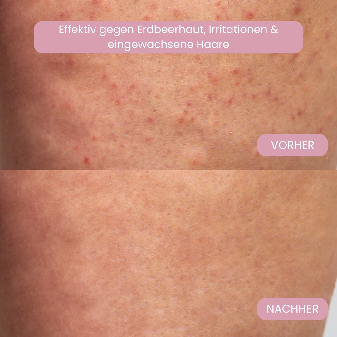 Femora™ Intimrasierer für Frauen – Sanfte Rasur ohne Irritationen