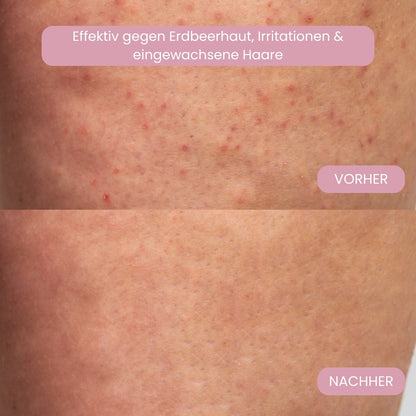 Femora™ Intimrasierer für Frauen – Sanfte Rasur ohne Irritationen
