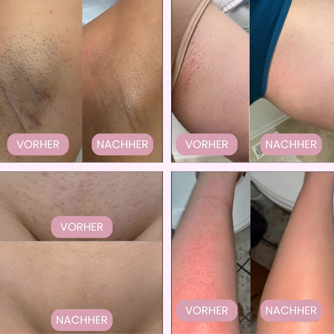 Femora™ Intimrasierer für Frauen – Sanfte Rasur ohne Irritationen