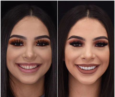 LumaGrin™ Snap-On Cosmetic Veneers – Temporäres Lächeln für Fotos & Events