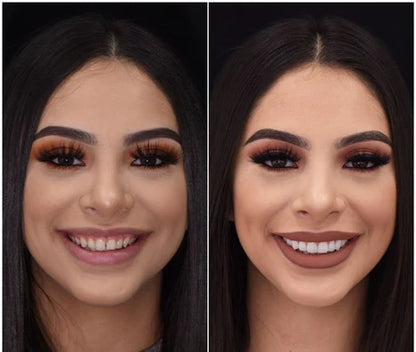 LumaGrin™ Snap-On Cosmetic Veneers – Temporäres Lächeln für Fotos & Events