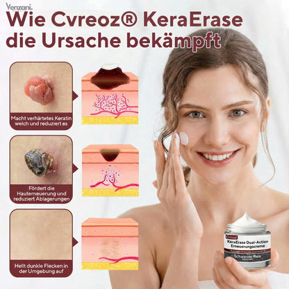 Cvreoz® KeraErase Dual-Action Erneuerungscreme - Die Kraft aus Schwarzem Reis gegen raue Stellen